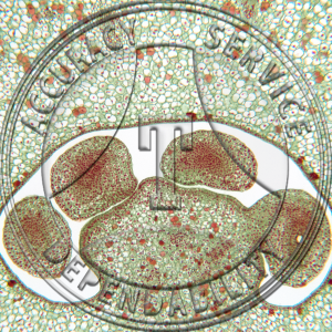 17-356-5 Podophyllum peltatum Ovary Prepared Microscope Slide