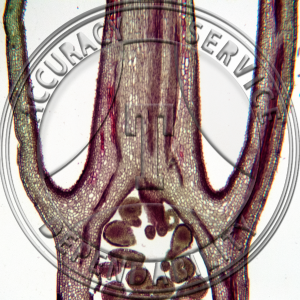 17-367-1 Ribes americanum Epigynous Bud LS Prepared Microscope Slide