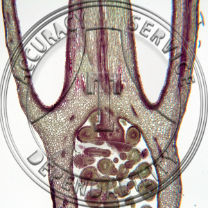 17-367-2 Ribes americanum Epigynous Bud Non Median LS Prepared Microscope Slide