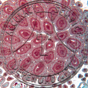 17-367A-5-Rubus-occidentalis-Flower-Bud-Median-LS-2-Level-CS-Prepared-Microscope-Slide-CS2