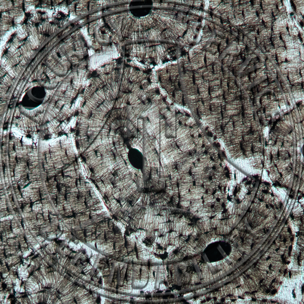 Bone Human Lamella Prepared Microscope Slide