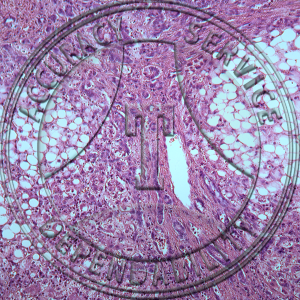 Liver Cirrhosis Prepared Microscope Slide