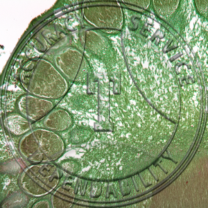 Clacviceps purpurea Stroma Asci Prepared Microscope Slide