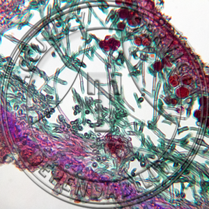 Umbilicaria Prepared Microscope Slide