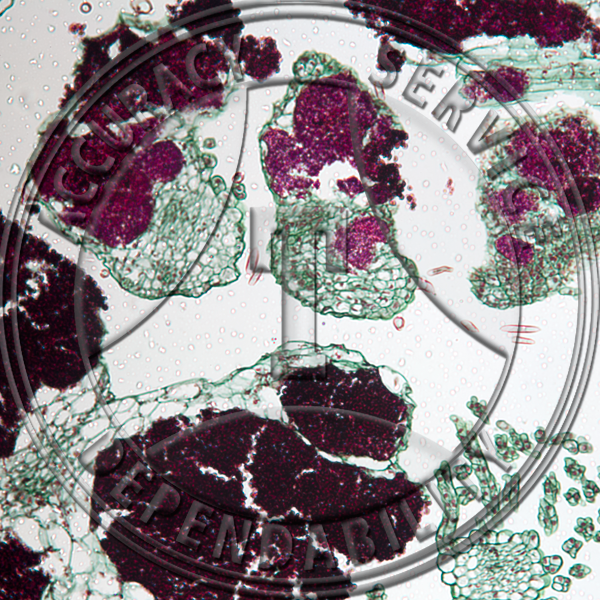 Ustilago levis Prepared Microscope Slide