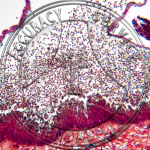 Cronartium ribicola Aecial Lesions Prepared Microscope Slide