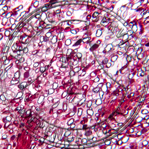 Gymnosporangium juniperi virginianae Telia Prepared Microscope Slide