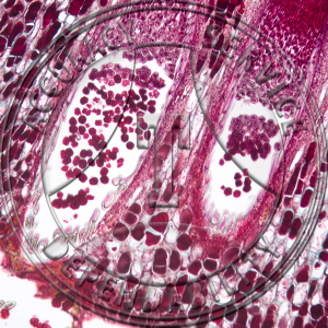 Gymnosporangium juniperi virginianae Aecia Spermogonia Microscope Slide