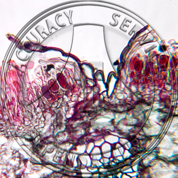 Puccinia coronata Uridinia Telia Prepared Microscope Slide