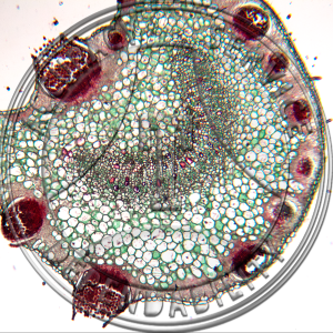 Puccinia coronata Aecia & Spermogonia Rhamnus Leaf Microscope Slide