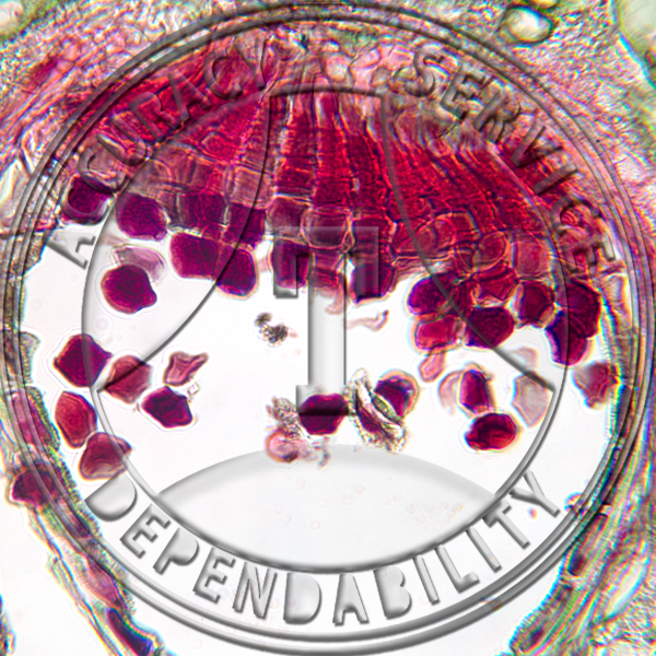 Puccinia sorghi Aecia Oxalis Prepared Microscope Slide