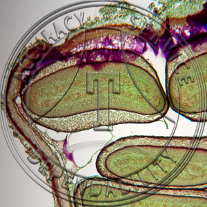 Uromyces appendiculatus Prepared Microscope Slide