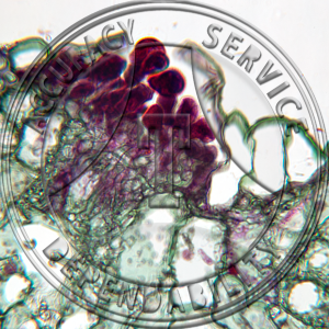 Puccinia dispersa Secale Prepared Microscope Slide