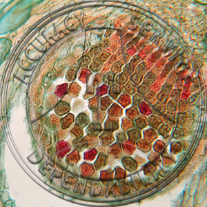 Puccinia pustulata Comandra Prepared Microscope Slide