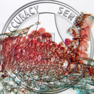 Uromyces toxicodendri Prepared Microscope Slide