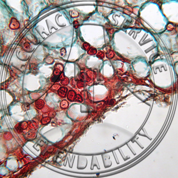 Entyloma australe Smut Lesions Physalis Prepared Microscope Slide
