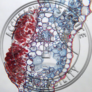 Schizonella melanogramma Smut Lesions Prepared Microscope Slide