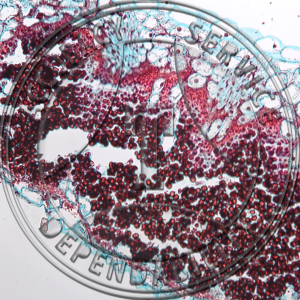 Urocystis anemones Smut Lesions Prepared Microscope Slide