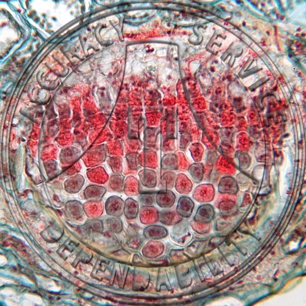 A-96 Cerotelium dicentrae Prepared Microscope Slide