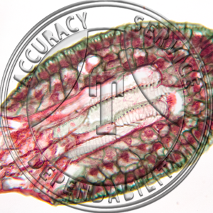15-315-1 Drosera rotundifolia Leaf with Attached Digestive Glands Prepared Microscope Slide