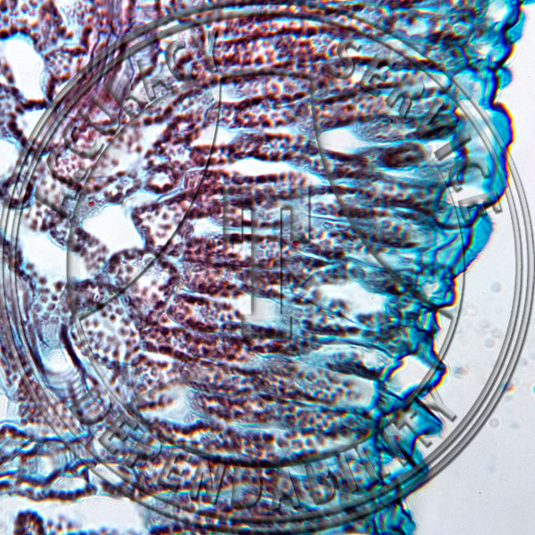 A-200 Solanum tuberosum Potato Mosiac Infected Leaf CS Prepared Microscope Slide