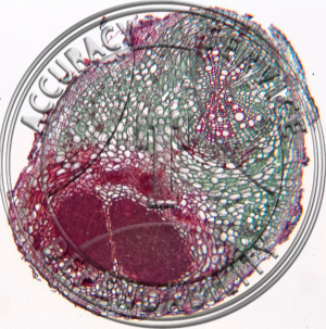 3-94C Glycine max Root with Attached Nodule Prepared Microscope Slide