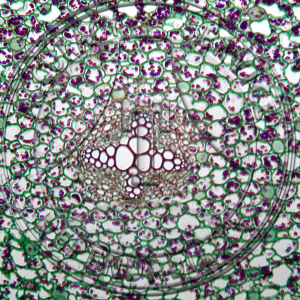 13-10a-4 Ranunculus acris Mature Root Tetrarch Prepared Microscope Slide