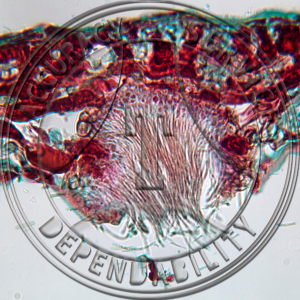 A-186 Septoria conspicua Prepared Microscope Slide