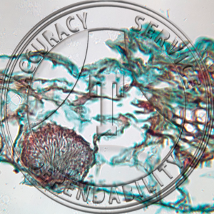 A-190 Septoria polygonorum Prepared Microscope Slide