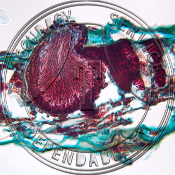 A-193 Septoria sambucina Prepared Microscope Slide