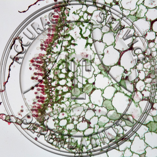 3-2B Albugo Bliti Sex Organs and Zygotes Prepared Microscope Slide