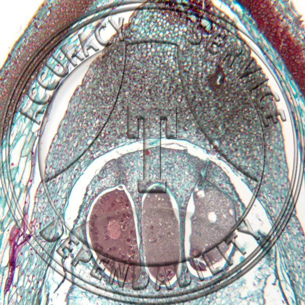 10-6S Pinus Archegonium Median LS Egg Nucleus Prepared Microscope Slide