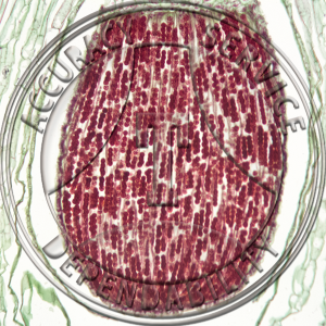 5-6M Marchantia polymorpha Sporophyte With Tetrads Prepared Microscope Slide