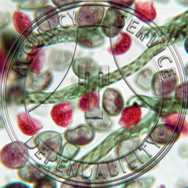 5-6O Marchantia polymorpha Meiosis in Spore Mother Prepared Microscope Slide