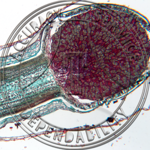 5-8C Pellia epiphylla Median Mature Dormant Sporophyte Prepared Microscope Slide