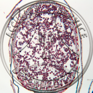 5-12F Porella Mature Sporophyte Median LS Prepared Microscope Slide 