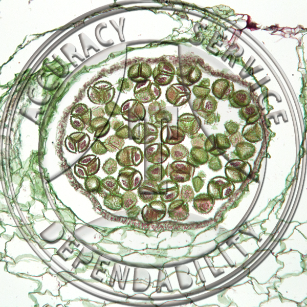 5-10CCC Ricciocarpus natans Sporophyte General Structure Prepared Microscope Slide 