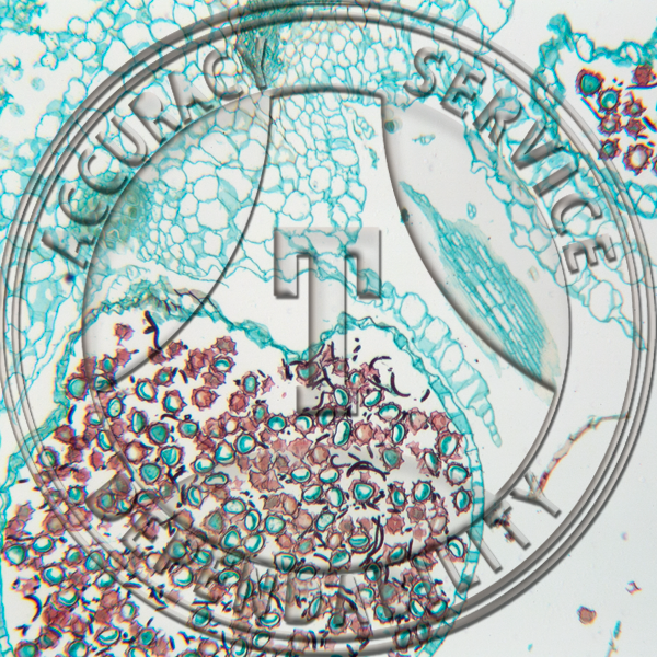 A-207-2 Reboulia Young Sporophyte LS Prepared Microscope Slide