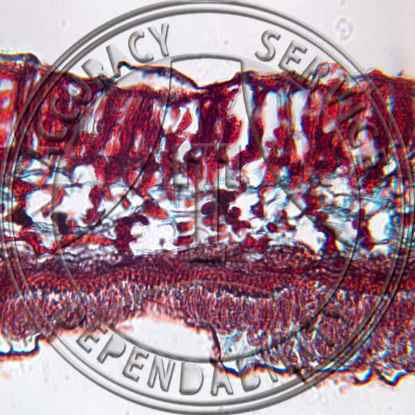 A-177 Marssonia juglandis Prepared Microscope Slide 