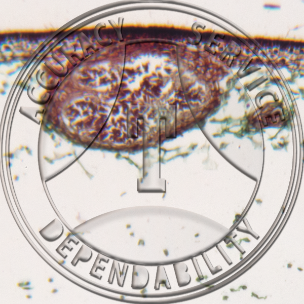 2-52A Fucus Median Male Conceptable Prepared Microscope Slide