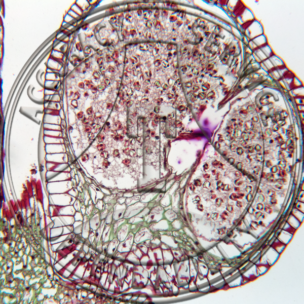 9-8CC Psilotum Sporangium Attached LS Prepared Microscope Slide